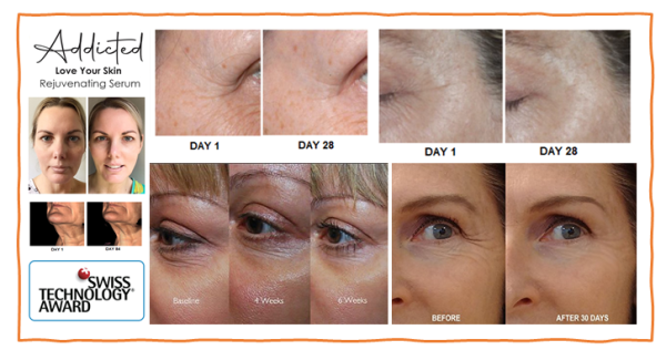 ADDICTED LOVE YOUR SKIN REJUVENATING SERUM Results Testimonies